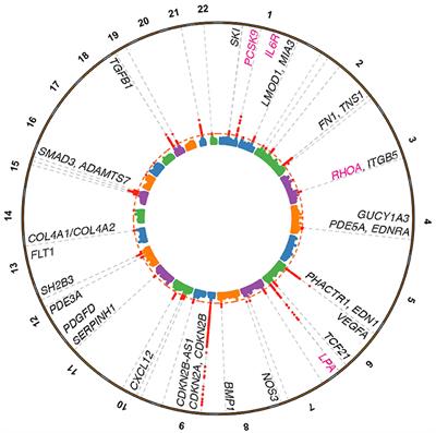 GWAS Reveal Targets in Vessel Wall Pathways to Treat Coronary Artery Disease